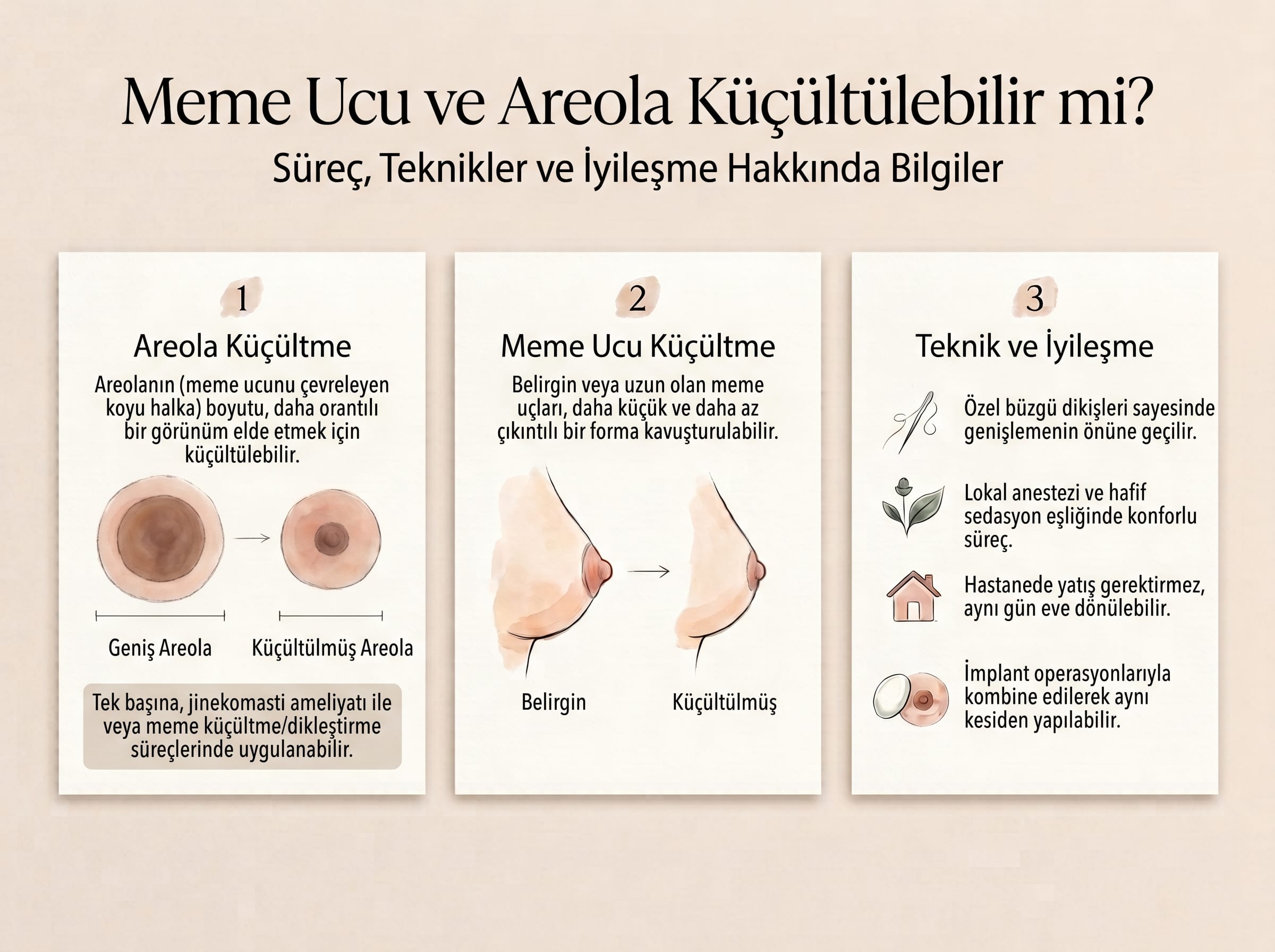 Areola ve meme başı küçültme işlemlerini, yaklaşık referans çapları, kalıcı purse-string dikiş, sedasyon ve lokal anestezi ile aynı gün taburculuk sürecini gösteren medikal infografik.